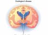 کره هانتینگتون چه بیماری ای است؟ علایم و نشانه های آن کدام ها هستند؟ تشخیص و درمان